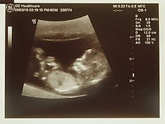 -1621_1_LilleNy_Justeret