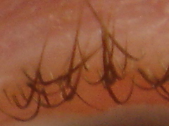 [Foto]